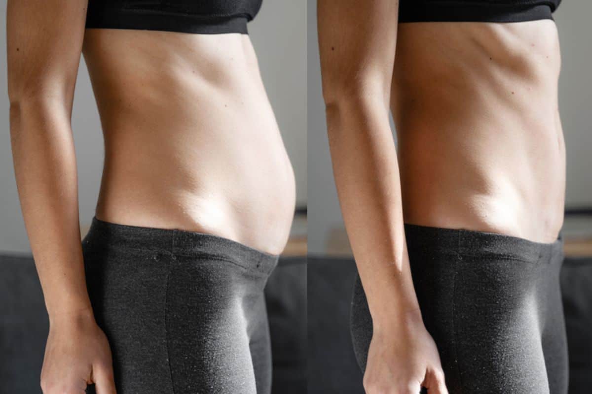 Post-Pregnancy: What Happens to Your Abdominal Muscles After Birth Chorleywood