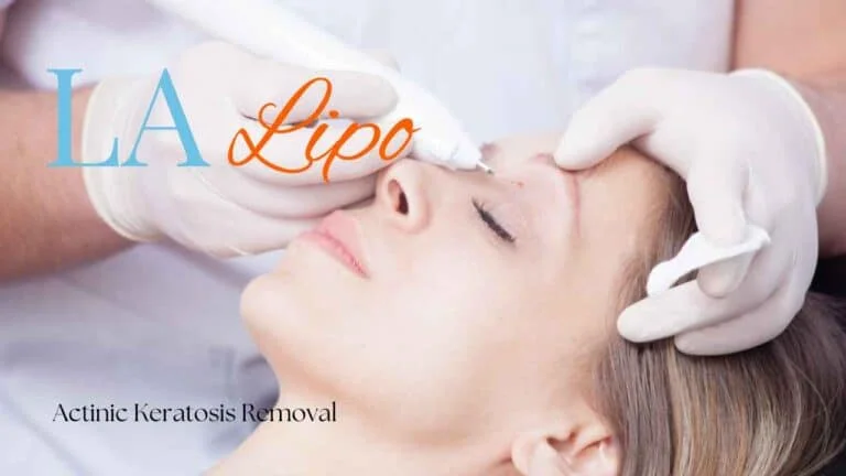 Woman receiving Actinic Keratosis Removal Treatment Chorleywood