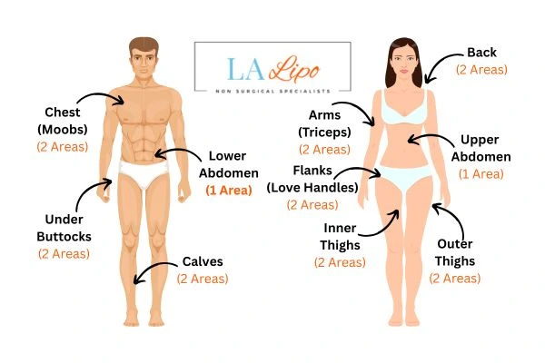 LA LIPO Cryolipolysis Areas Chorleywood