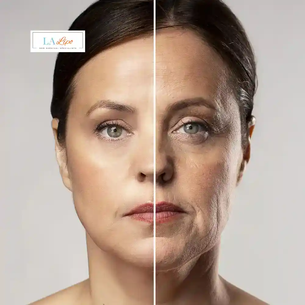 How Can You Tell If Non-Surgical Skin Tightening Is Right for You Chorleywood?