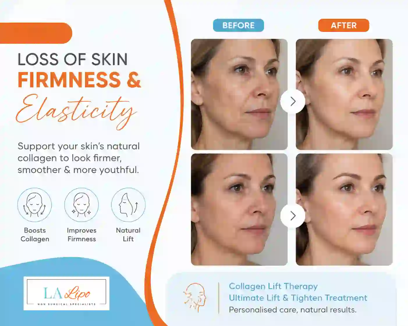 Sign #7: Loss of Skin Firmness and Elasticity Chorleywood