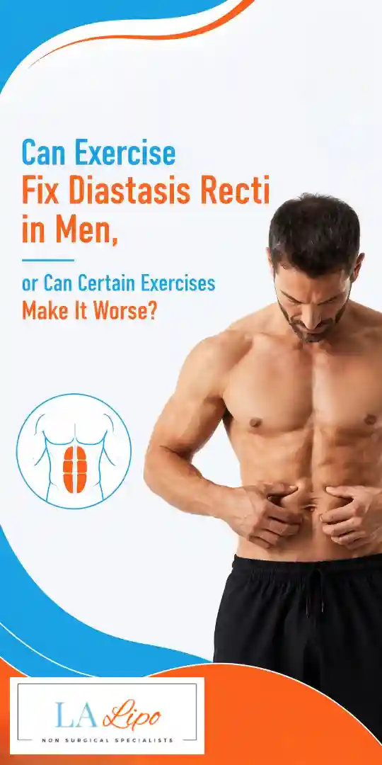 Can Exercise Fix Diastasis Recti in Men, or Can Certain Exercises Make It Worse Chorleywood?
