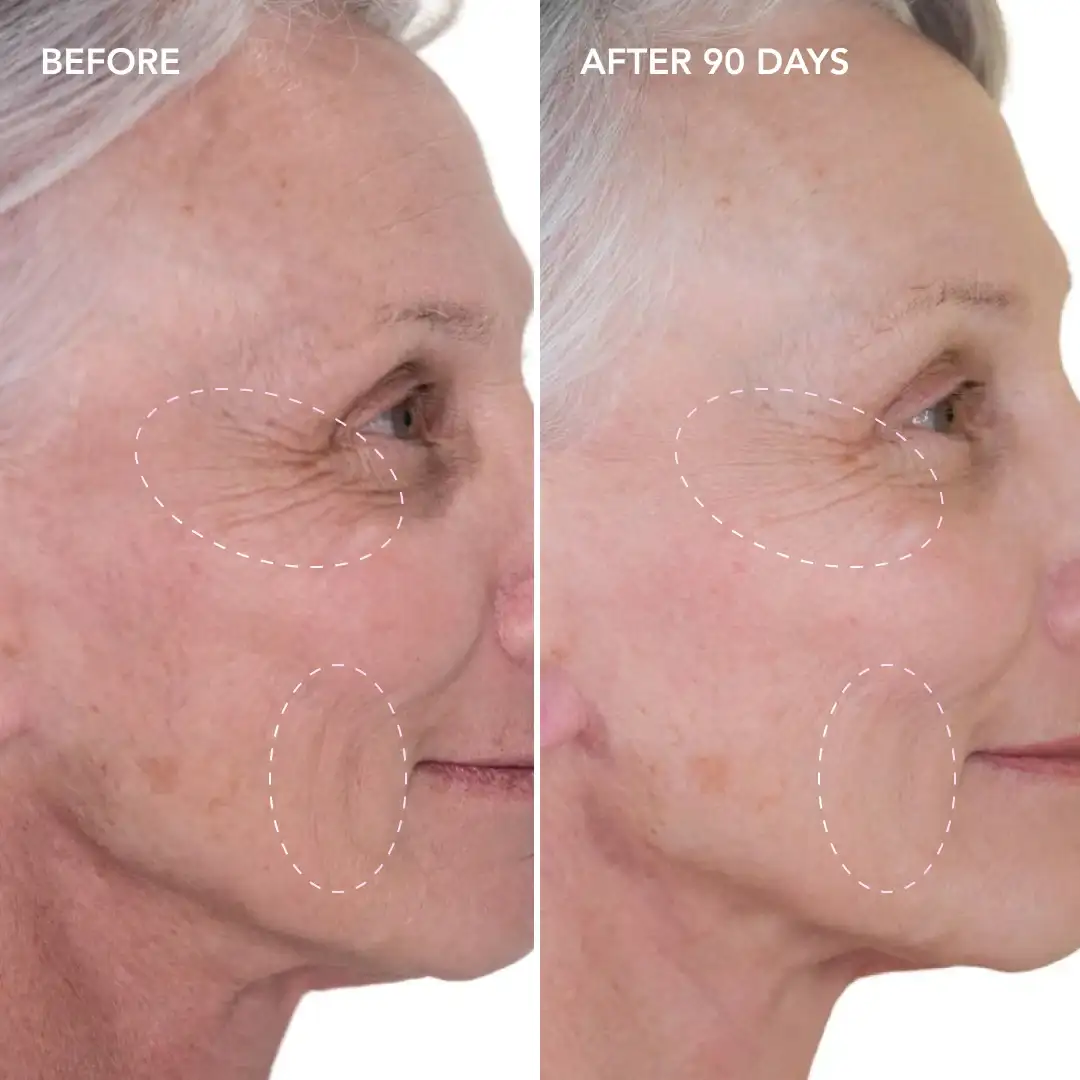When will you see results Chorleywood